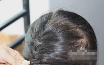 Сôͷÿ СƯͷı෨